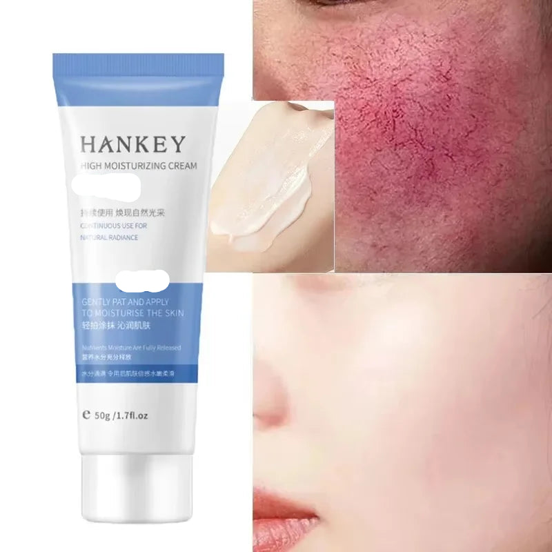 Crème Apaisante Rosacée 7 Jours