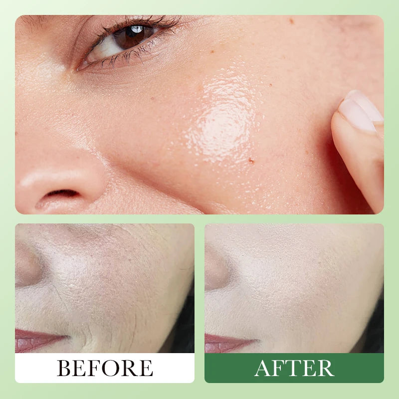 Huile Avocat-Amande: Soin Hydratant & Anti-Âge